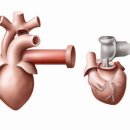 생명과 직결되는 ‘심장판막증’ – 4가지 원인 및 증상과 예방법 이미지