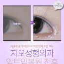 강구외과 앞 이미지