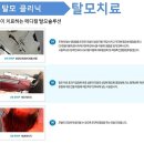 진피부사랑