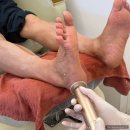 클린풋 | 대구 내당동 무좀 발톱 클린풋네일 문제성 발관리 각질 제거 후기