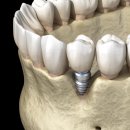 란치과의원 이미지