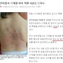 부산 어린이집 폭행사건~ 교사 신상 공개. 사건 총정리 이미지