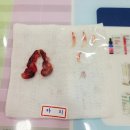 아리동물병원 | [반려동물/댕댕이 일기] 대구 이솝동물병원에서 진행한 암컷 강아지 중성화 수술과 회복기 🐶