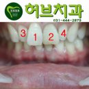 허브 치과기공소 이미지