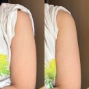 예비신부 홈케어템 티마뷰티 페이스 앤 바디롤러괄사