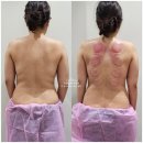 1회만으로 독소배출, 림프순환을 도와주는 전주체형관리, 삼천동 아띠뷰티살롱