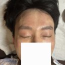 영통 미소로한의원 아토피치료 후기