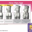 힙프로짐 이미지