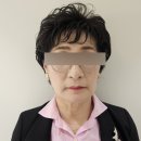 우리의원 | 청담아르티의원 레디어스 받고 우리 엄마 팔자주름 확실히 달라진 후기