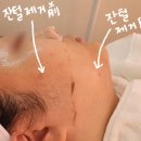 아모레퍼시픽경기지사 | [스킨글림]노원 피부관리 / 세라링 / 잔털제거&각질제거&피부관리 한번에👍🏻(대만족🫢)