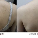 글래시피부과