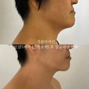 더라인 이미지