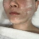미닝필 | [구월동에스테틱] 화이트위치 :: 겨울철 트러블피부 수분필 관리 후기