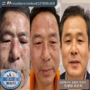 인셀덤안산점 | 인셀덤 실제 사용후기 #안산인셀덤 #문경인셀덤 #시흥인셀덤 #광교인셀덤 #인셀덤안산