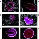 Re:Serum ferritin is an important inflammatory disease marker 혈청페리틴은 왜 활성산소(산화스트레스)의 표지자인가? 이미지