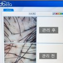 서초고용센터 앞 | 강남탈모관리 모리셋두피재생센터 서초점에서 탈모관리 스위스 모낭플란트 받은 후기