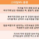 김수현피부