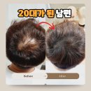 나는 소년이었다 SMP | 서울 홍대 두피케어 잘 하는 샵 추천 나는 소년이었다 40대 남편 20대로 환골탈태 후기