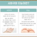 양재역피부과) 오라클피부과 티눈치료 :) 아주굿