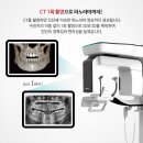 미듬치과 네이버블로그