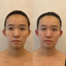 다이아에스테틱 | 압구정 피부관리 성형 전 컨디션 관리 릴리프 드레나지 케어 후기 다이아에스테틱