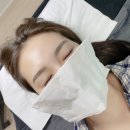 임브로우