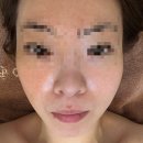폭탄머리 - 부평구 | [부산 금정구 에스테틱] 올리다 에스테틱 | 여름철 속건조 채워주는 수분폭탄관리 후기