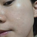 퍼펙트홈케어 - 서구 갈마로295번길 10 | 속건조 때문에 시작한 엑솜 퍼펙트클렌저 & 카밍크림 홈케어 루틴 후기