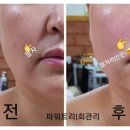 모아 스킨케어
