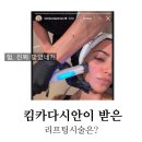 (주)루트로닉 | 킴 카다시안이 받은 리프팅, 세르프(XERF) 뭐길래?