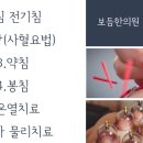 보듬한의원 | 하남무릎통증 슬개골위통증 Jumper's knee 보듬한의원