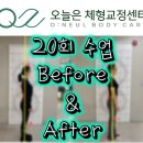 생체전기 모든통증완화센터 | 허리 통증, 하체 부종 없애는 최고의 운동! 동성로 필라테스 20회 수업 찐후기.