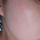 느낌있는 걸 | 닥터끌레르 멜라앤턴 기미, 잡티크림 화이트닝크림 리얼 사용 후기 전후 느낌 비교