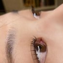 트레졸리 이미지