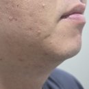 한불화장품;한불피부관리실 | 올리브영 쉐이빙젤 | 남자 여드름 피부에 사용가능한불독 오리지널 쉐이브젤