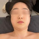 1529 | 순천웨딩관리 추천 한올왁싱앤리프팅 | 즉각효과 본 쫀턱 리프팅 순천윤곽관리 후기