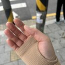 금천삼성본정형외과의원 | 서울 금천 [삼성본정형외과] 자전거타다 날파리한테 뚜까맞고 인대파열 / 정형외과 치료후기