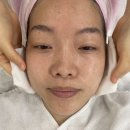 유성메디컬 | 유성피부관리 추천, 유성에스테틱 땡스윤 1:1 맞춤 피부관리 후기