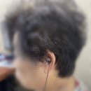 논산독일보청기