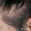 더고은만의 특별한 두피관리가 궁금하다면? 다산두피전문케어