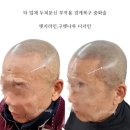 7471 | 광명.안양.산본.군포.새솔동.동탄.광교.인천.송도.천안.대전.화성.일산.성남 부분탈모 두피smp학원수강
