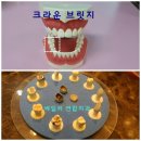 베일러연합치과 네이버블로그