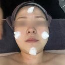용문시장예뻐 고주파피부관리 받고 온 후기｜용산예뻐 고주파리프팅으로 얼굴라인 관리부터 데콜데...