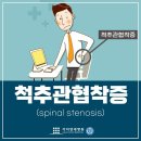 김포척추관협착증 보다 치료가 시급해요 이미지