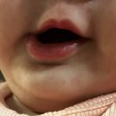 아이비스킨&바디 | [아기수딩젤 추천] 여름 아기 피부 태열 진정 추천템 리숨센텔라 시카 아이비 수딩젤