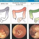 대장암 예방에 좋은 과일, 채소 이미지