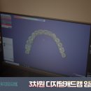 주안치과기공소 네이버블로그