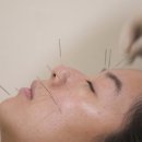 김포제일한의원 네이버블로그