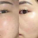 배탈고개, 일신건영아파트 정류장(좌) | 구리 피부관리 잘하는 곳, 미플 구리점에서 미라클 화이트닝 받고 온 솔직후기!