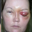 밥성형외과의원 이미지